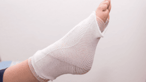 Foot in a bandage; new biotechnology
